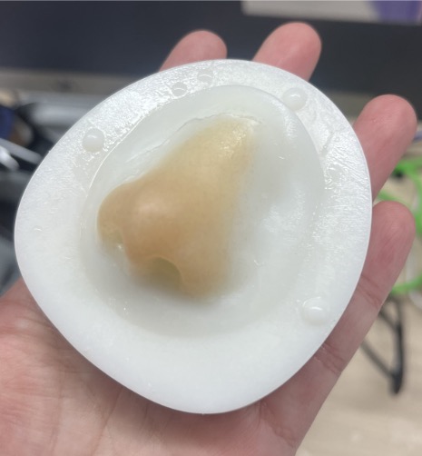 Nasal Prosthesis